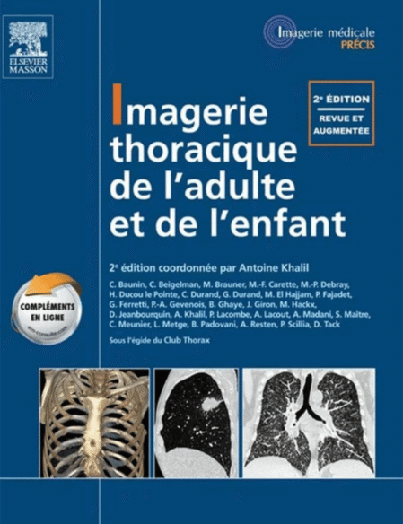Imagerie thoracique de l'enfant et de l'adulte, (Imagerie médicale : Précis) 2nd Edition